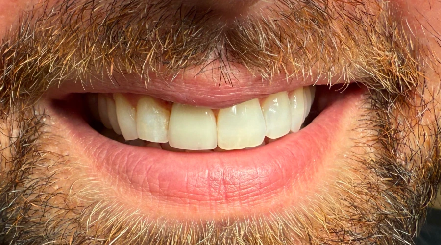 lux_dental SG After 1