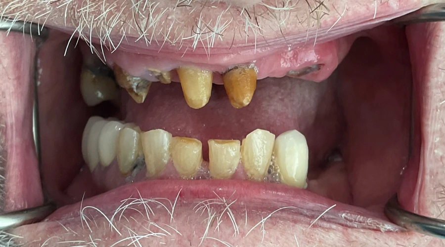 patient 1 before